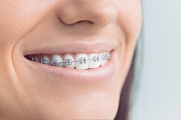 Full Mouth Reconstruction in Bally, PA